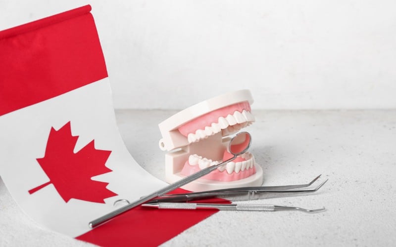 jaw model dental-tools flag canada white table